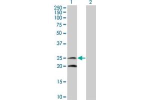 Western Blot analysis of IL6 expression in transfected 293T cell line by IL6 monoclonal antibody (M08), clone 2C5. (IL-6 anticorps  (AA 29-212))