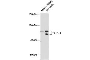 Western blot analysis of extracts of various cell lines, using ST antibody (ABIN7270305) at 1:1000 dilution.