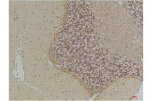Immunohistochemistry (IHC) analysis of paraffin-embedded Rat Brain Tissue using GABA Transporter 1 Rabbit Polyclonal Antibody diluted at 1:200. (SLC6A1 anticorps)