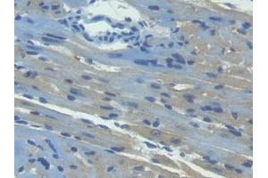 Detection of ITaC in Mouse Heart Tissue using Polyclonal Antibody to Interferon Inducible T-Cell Alpha Chemoattractant (ITaC) (CXCL11 anticorps  (AA 22-100))