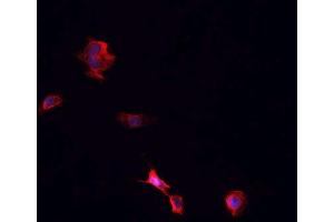 ABIN6266742 staining Hek293 cells by IF/ICC. (TNFRSF1B anticorps  (C-Term))