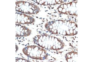 Immunohistochemistry of paraffin-embedded human colon using MUC4 Rabbit mAb (ABIN7268692) at dilution of 1:100 (40x lens). (MUC4 anticorps)