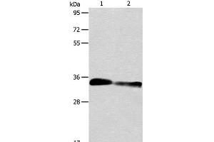Western Blot analysis of Mouse kidney and Rat kidney tissue using ACY3 Polyclonal Antibody at dilution of 1:750 (Aminoacylase 3 anticorps)