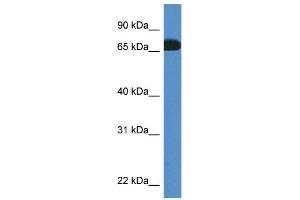 WB Suggested Anti-Pros1 Antibody Titration: 1. (PROS1 anticorps  (C-Term))