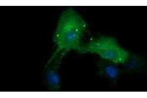 Image no. 3 for anti-Cancer/testis Antigen 1B (CTAG1B) antibody (ABIN1499890) (CTAG1B anticorps)