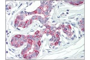 Human Breast: Formalin-Fixed, Paraffin-Embedded (FFPE)