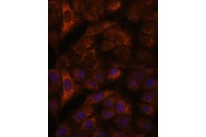 Immunofluorescence analysis of U-2 OS cells using HEBP2 antibody (ABIN7267604) at dilution of 1:100. (HEBP2 anticorps  (AA 1-205))