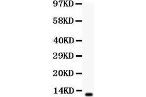 Anti-beta Defensin 1 antibody,Western blotting All lanes: Anti Defensin 1  at 0.