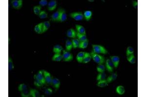 Immunofluorescence staining of Hela cells with ABIN7164887 at 1:66, counter-stained with DAPI. (PTOV1 anticorps  (AA 2-137))