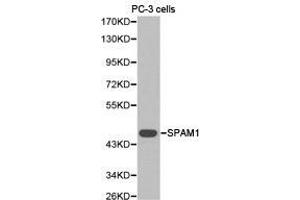 Western Blotting (WB) image for anti-Sperm Adhesion Molecule 1 (PH-20 Hyaluronidase, Zona Pellucida Binding) (SPAM1) antibody (ABIN1874917) (SPAM1 anticorps)