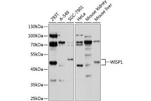 Western blot analysis of extracts of various cell lines, using WISP1 antibody (ABIN1683290, ABIN3017735, ABIN3017736 and ABIN6220223) at 1:1000 dilution.