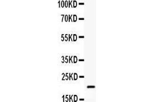 Anti- BCL2L2 antibody,  Western blotting All lanes: Anti BCL2L2 () at 0. (BCL2L2 anticorps  (Middle Region))