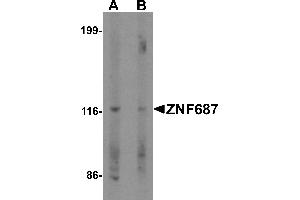 Western blot analysis of ZNF687 in Jurkat cell lysate with ZNF687 antibody at 0. (ZNF687 anticorps  (C-Term))