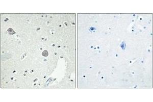 Immunohistochemistry analysis of paraffin-embedded human brain tissue, using DRD1 Antibody.
