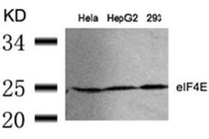 Image no. 3 for anti-Eukaryotic Translation Initiation Factor 4E (EIF4E) (Ser209) antibody (ABIN197473) (EIF4E anticorps  (Ser209))