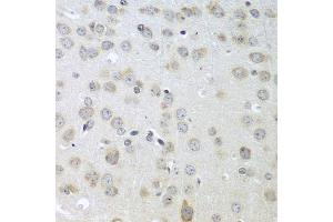 Immunohistochemistry of paraffin-embedded mouse brain using ACHE antibody.