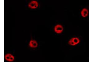 ABIN6274031 staining HepG2 by IF/ICC.