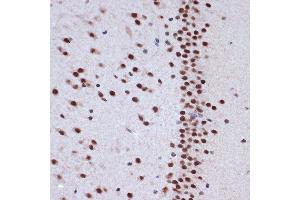 Immunohistochemistry of paraffin-embedded rat brain using A Rabbit mAb (ABIN7265387) at dilution of 1:100 (40x lens). (BAF53A anticorps)
