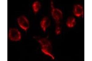 ABIN6275975 staining Hela by IF/ICC.