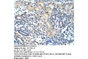 Rabbit Anti-WBSCR1 Antibody  Paraffin Embedded Tissue: Human Kidney Cellular Data: Epithelial cells of renal tubule Antibody Concentration: 4. (EIF4H anticorps  (Middle Region))