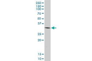 SIP1 MaxPab polyclonal antibody.