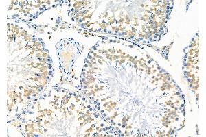 ABIN6261053 and ABIN6278784 at 1/100 staining Rat testis tissue by IHC-P.