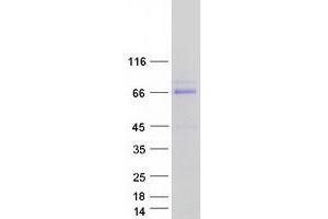 Validation with Western Blot