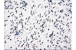 Image no. 1 for anti-Nuclear Receptor Binding Protein 1 (NRBP1) antibody (ABIN1499822)