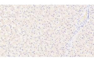 Detection of S100A9 in Human Liver Tissue using Monoclonal Antibody to S100 Calcium Binding Protein A9 (S100A9) (S100A9 anticorps  (AA 1-114))