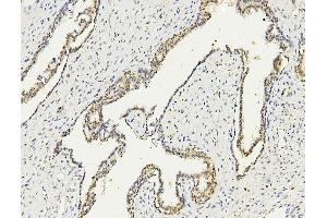 IHC analysis of PARN using anti PARN antibody (ABIN6719422). (PARN anticorps  (AA 1-301))