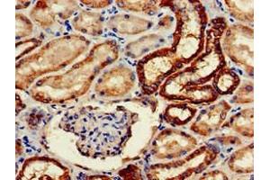 Immunohistochemistry of paraffin-embedded human kidney tissue using ABIN7161126 at dilution of 1:100 (WWP2 anticorps  (AA 145-367))