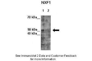 Lanes:   Lane 1: 7ug HeLa lysate+EGFP SiRNA  Lane 2: 7ug HeLa lysate+NXF1 SiRNA  Primary Antibody Dilution:   1:300  Secondary Antibody:   Anti-rabbit-HRP  Secondary Antibody Dilution:   1:500  Gene Name:   NXF1  Submitted by:   Seiji Masuda, Kitashirakawa Oiwakecho, Kyoto University  NXF1 is supported by BioGPS gene expression data to be expressed in HeLa