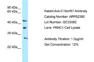 Western Blotting (WB) image for anti-U6 SnRNA Biogenesis 1 (USB1) (C-Term) antibody (ABIN2789122)