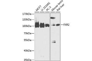 Western blot analysis of extracts of various cell lines, using FXR2 antibody (ABIN6133713, ABIN6140833, ABIN6140834 and ABIN6218331) at 1:1000 dilution.