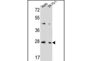 T4S4 Antibody (N-term) (ABIN653705 and ABIN2843022) western blot analysis in A549,ZR-75-1 cell line lysates (35 μg/lane).