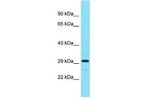 Host: Rabbit Target Name: ADPRHL1 Sample Type: RPMI-8226 Whole Cell lysates Antibody Dilution: 1.