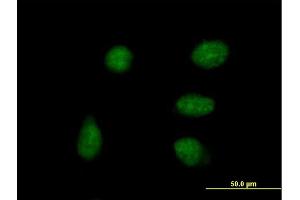 Immunofluorescence of purified MaxPab antibody to DPPA4 on HeLa cell. (DPPA4 anticorps  (AA 1-304))