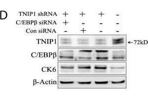 TNIP1 modulates the proliferation of keratinocytes by targeting Erk1/2 and C/EBPβ. (CEBPB anticorps  (N-Term))