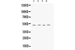 Anti- Keratocan Picoband antibody, Western blottingAll lanes: Anti Keratocan  at 0. (KERA anticorps  (C-Term))