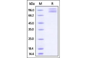 Human ITGAV & ITGB3 Heterodimer Protein on SDS-PAGE under reducing (R) condition.
