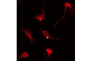 ABIN6269218 staining A2780 by IF/ICC.