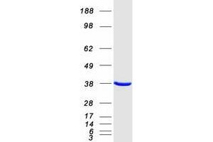 Validation with Western Blot