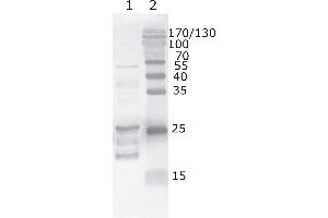 Western Blot testing of HIV-1 recombinant Tat protein. (HIV-1 Tat anticorps  (AA 59-67))