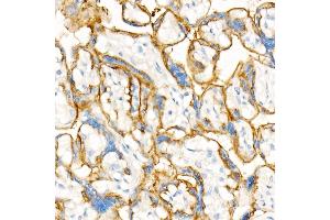Immunohistochemistry of paraffin-embedded Human placenta using CD147/BSG antibody (ABIN7265838) at dilution of 1:100 (40x lens). (CD147 anticorps)