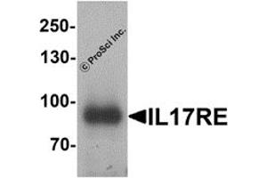Western Blotting (WB) image for anti-Interleukin 17 Receptor E (IL17RE) antibody (ABIN1077424)