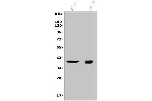 Western blot analysis of CD72 using anti-CD72 antibody (ABIN7602483).