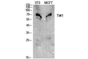 Western Blotting (WB) image for anti-Nuclear Receptor Subfamily 2, Group C, Member 2 (NR2C2) (Tyr142) antibody (ABIN3187165)