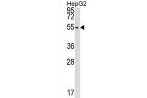 Western Blotting (WB) image for anti-Cleavage and Polyadenylation Factor I Subunit 1 (CLP1) antibody (ABIN2999240) (CLP1 anticorps)