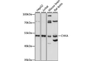 Western blot analysis of extracts of various cell lines, using CHKA antibody (ABIN7266342) at 1:1000 dilution. (Choline Kinase alpha anticorps  (AA 1-170))