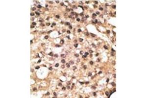 anti-Autophagy related 4B Cysteine Peptidase (ATG4B) (AA 23-53), (N-Term) antibody